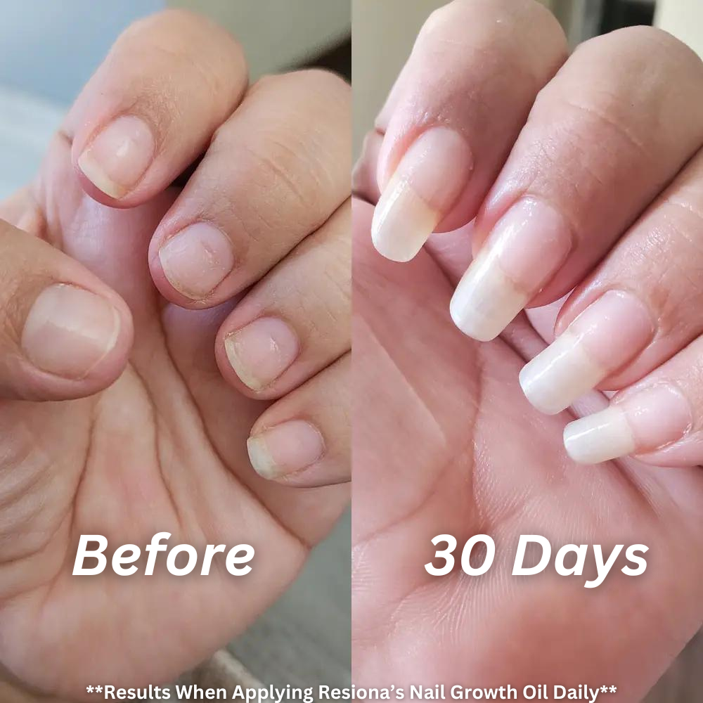 Resiona Nail Growth Oil™